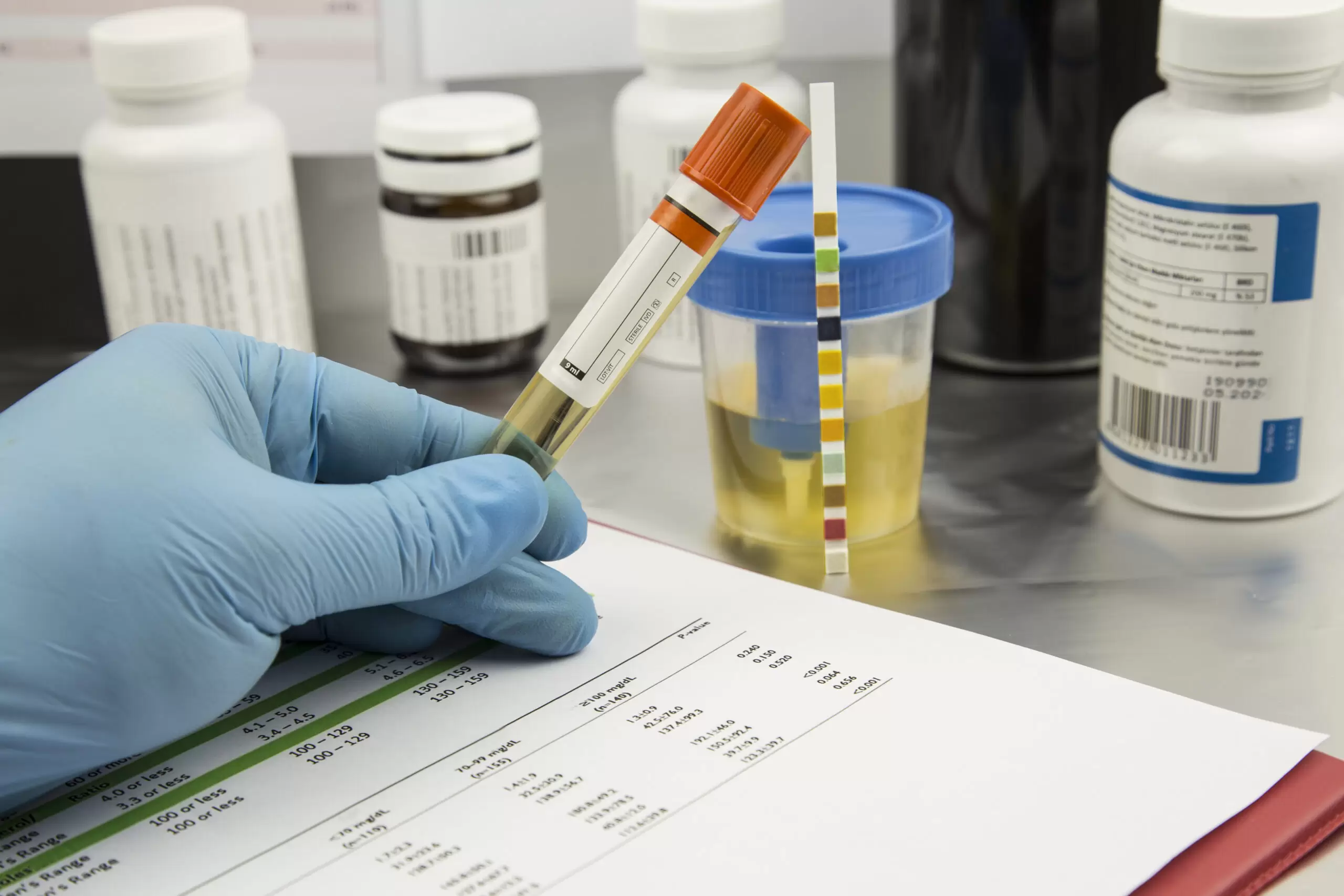 Urine test analysis strip for drug testing.